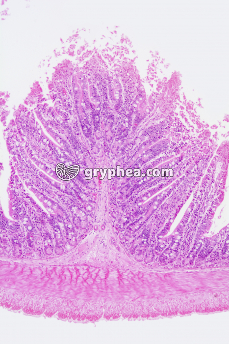 Valvule connivente x25 - gryphea.org